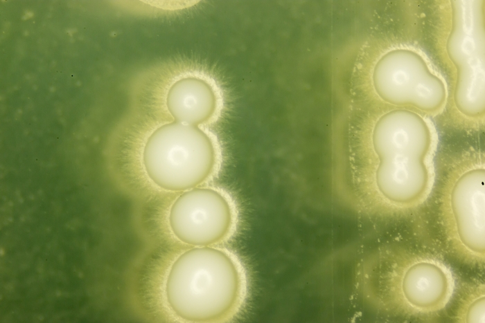 Image of yeast cells