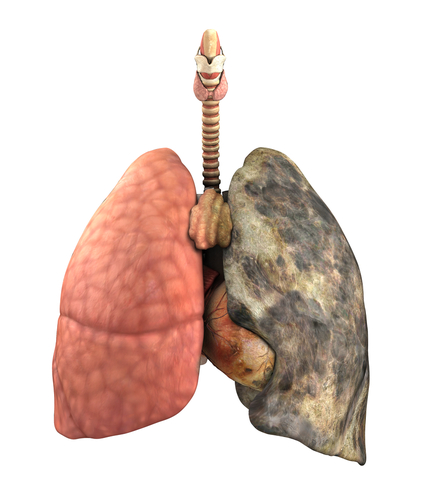 Image of healthy lungs and smoker lungs