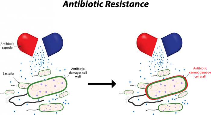 Antibiotic resistance in bacteria
