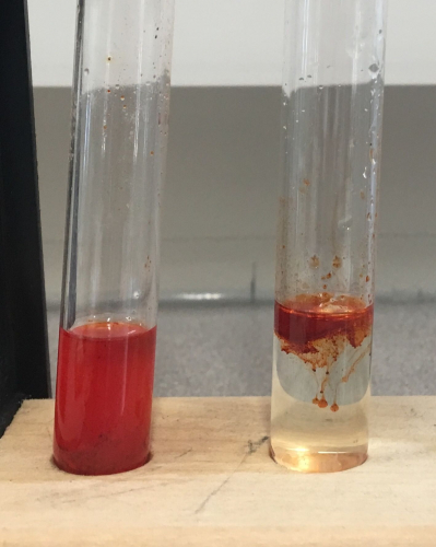 Sudan III test for lipids