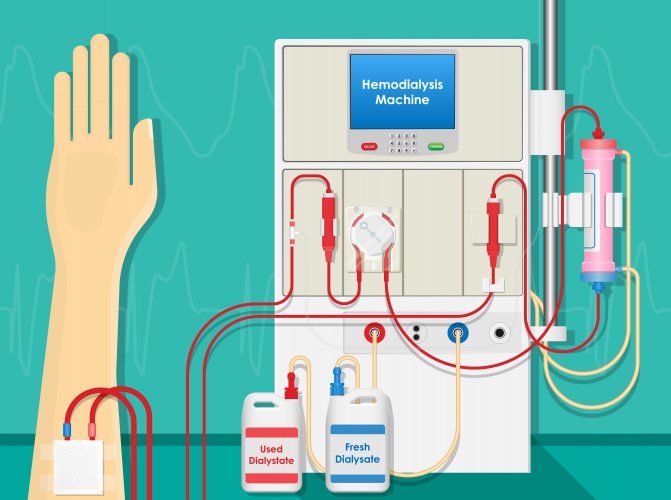 A dialysis machine