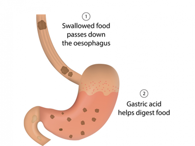 Image of stomach 