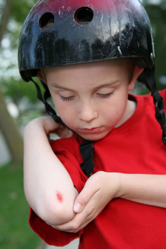 Child cut grazed elbow