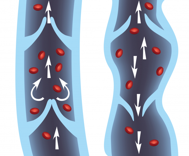 Image of vein with valves