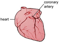 Image of the coronary artery in the heart