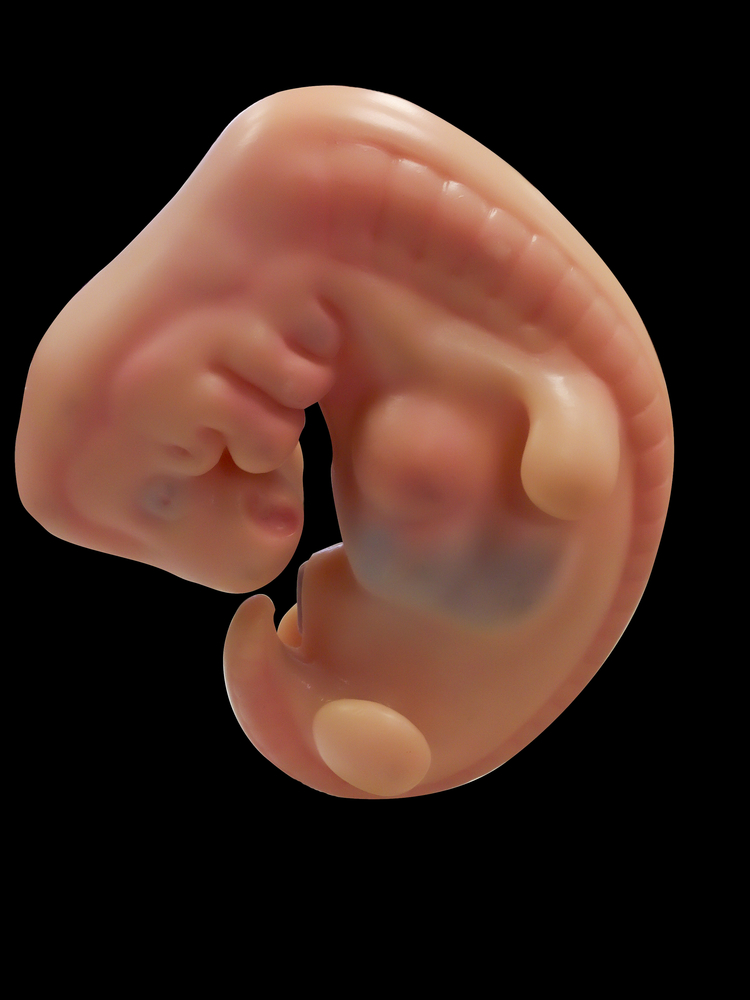 Image of a human embryo
