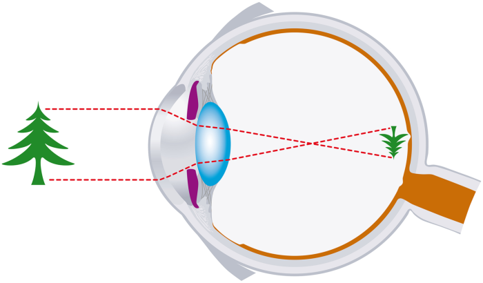 human eye forming an image